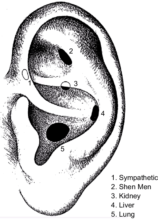 Auricular Acupuncture Points